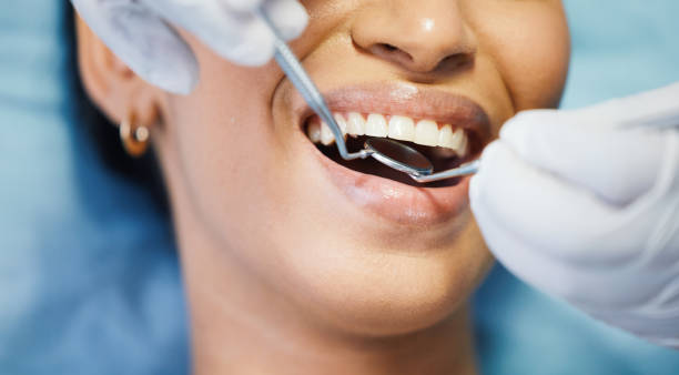 Best Emergency Dental Care for Abscessed Tooth in Broussard, LA